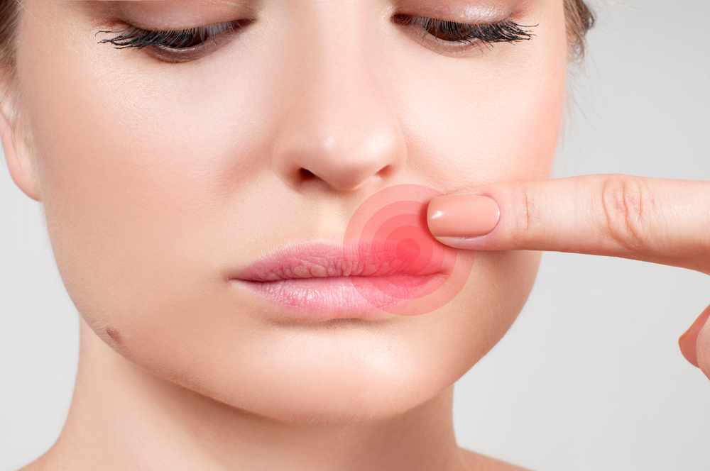 Gerissen lippenbändchen ᐅ Lippenbändchen