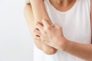jucken nach pilzbehandlung